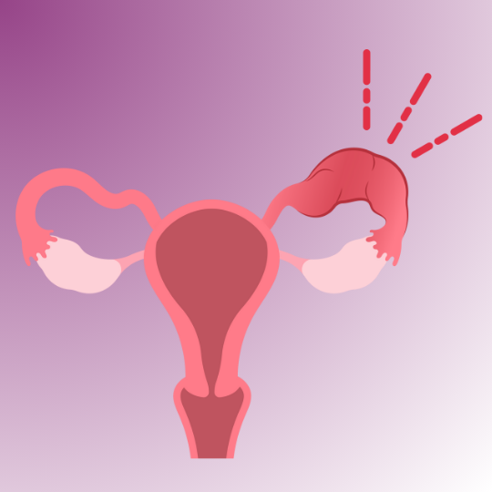 Tubal Blockage Treatments