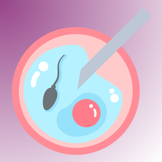 Surgical Sperm Retrieval Surgical Sperm Retrieval
